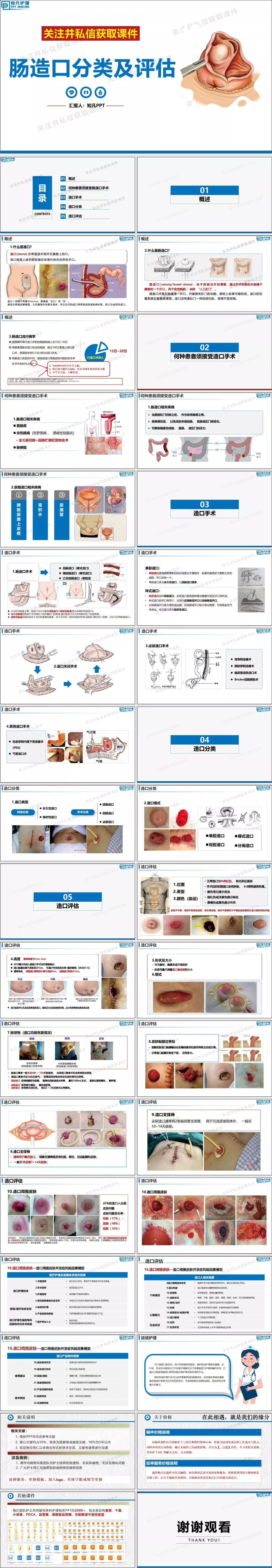 直肠造口正常图片图片